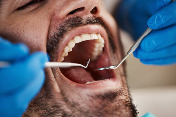 Laser Dentistry in Babson Park, FL